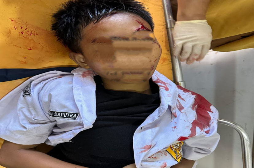 Siswa Pelajar SMPN 12 Krui Tewas Diduga Berkelahi Sesama Pelajar