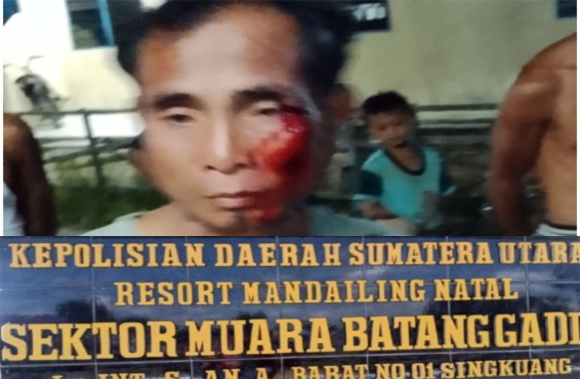 Pelaku Pengeroyokan Masih Berkeliaran, Kinerja Kapolsek Muara Batang Gadis Dipertanyakan